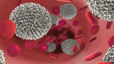 Identifican cómo superar la resistencia al tratamiento para la leucemia