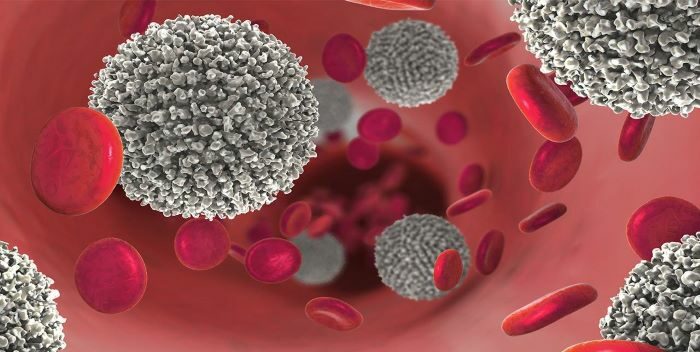 Identifican cómo superar la resistencia al tratamiento para la leucemia