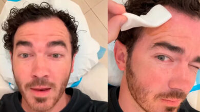 Kevin Jonas fue intervenido para tratar cáncer de piel