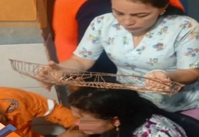 Rejilla de ventilador se desprendió e incrustó en la cabeza de una mujer en Táchira