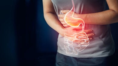 El colon irritable afecta a 15% de la población