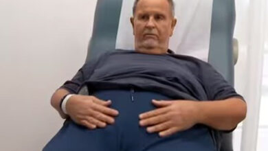 Raúl de Molina habla de sus complicaciones tras cirugía estética: me quitaron 15 libras de pellejo