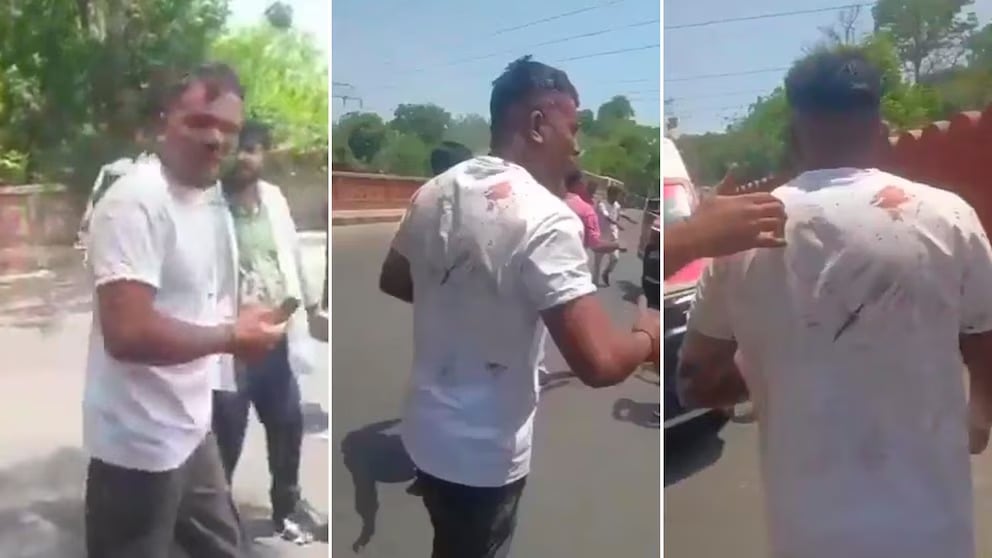 Así salió caminando el único sobreviviente del avión de Air India que se estrelló con 242 personas a bordo