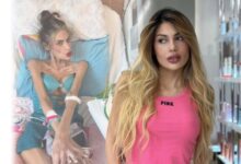 Muere influencer turca a sus 30 años tras batallar contra la anorexia