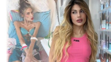 Muere influencer turca a sus 30 años tras batallar contra la anorexia