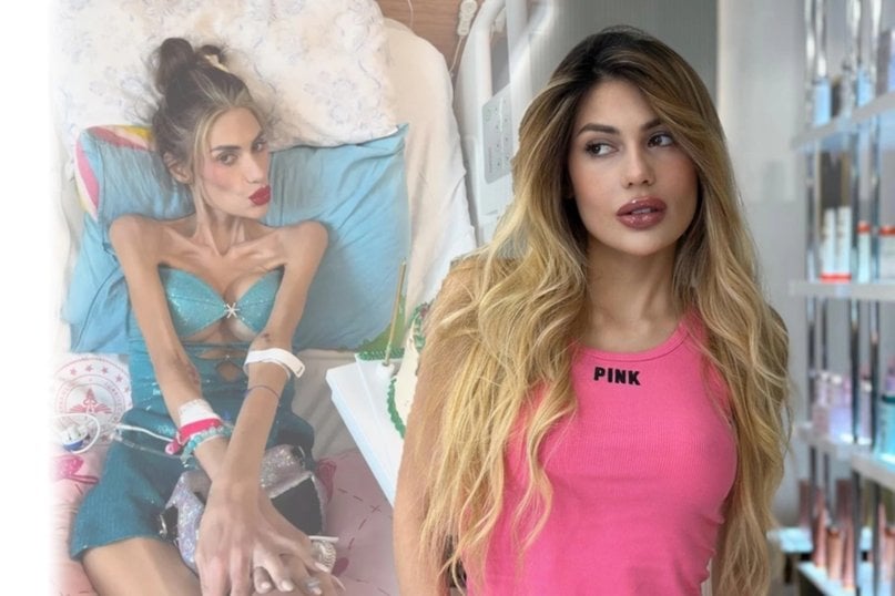 Muere influencer turca a sus 30 años tras batallar contra la anorexia