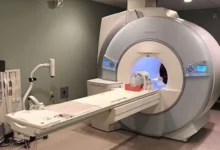 Sexagenario termina gravemente herido tras ser succionado por máquina de resonancia magnética: llevaba un collar de metal