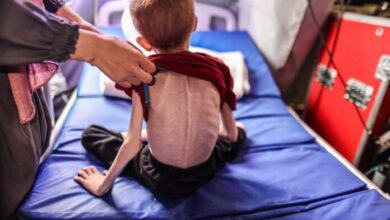 Un hospital de Gaza asegura que 21 niños murieron de hambre o desnutrición