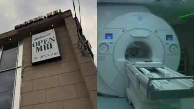 Un hombre murió tras ser arrastrado por una máquina de resonancia magnética