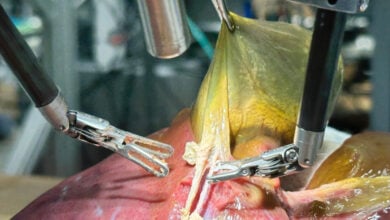 Avance histórico: un robot realiza por primera vez una cirugía realista sin ayuda humana