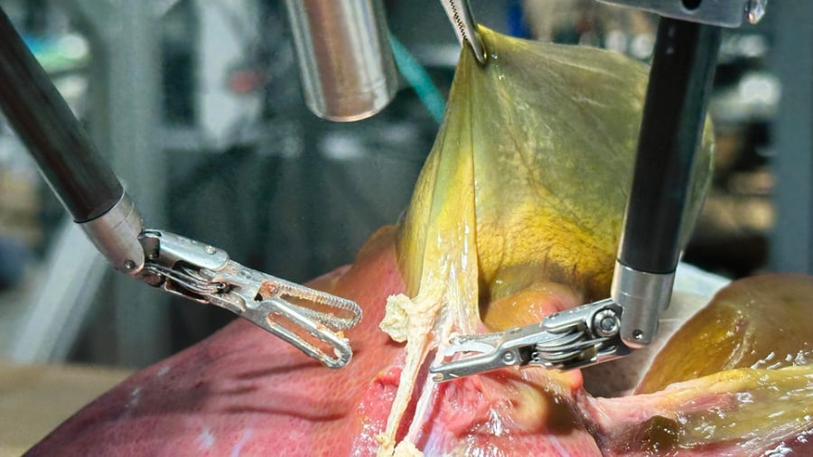 Avance histórico: un robot realiza por primera vez una cirugía realista sin ayuda humana