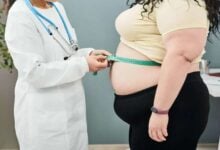 Estudio: Obesidad en mujeres aumenta el riesgo de cáncer
