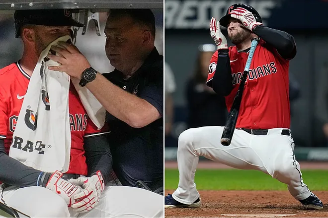 Beisbolista David Fry Sufre Brutal Pelotazo en la Cara Durante Juego de MLB