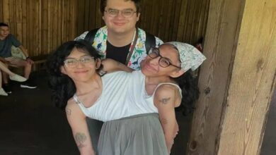 Gemelas siamesas Lupita y Carmen revelan cómo su vínculo funciona con el matrimonio de Carmen