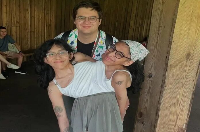 Gemelas siamesas Lupita y Carmen revelan cómo su vínculo funciona con el matrimonio de Carmen