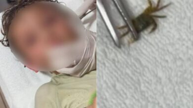 Cirujanos extraen un cangrejo vivo del oído de un niño en México