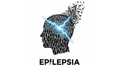 La epilepsia en Venezuela podría afectar a 1 de cada 10 personas, según la Sociedad Venezolana de Neurología