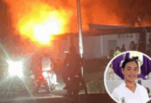 Enfermera de 25 años sufre graves quemaduras tras ser rociada con gasolina y quemada por su pareja