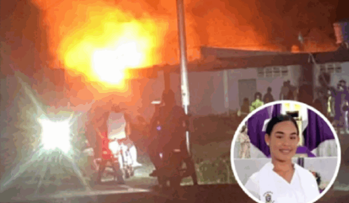 Enfermera de 25 años sufre graves quemaduras tras ser rociada con gasolina y quemada por su pareja