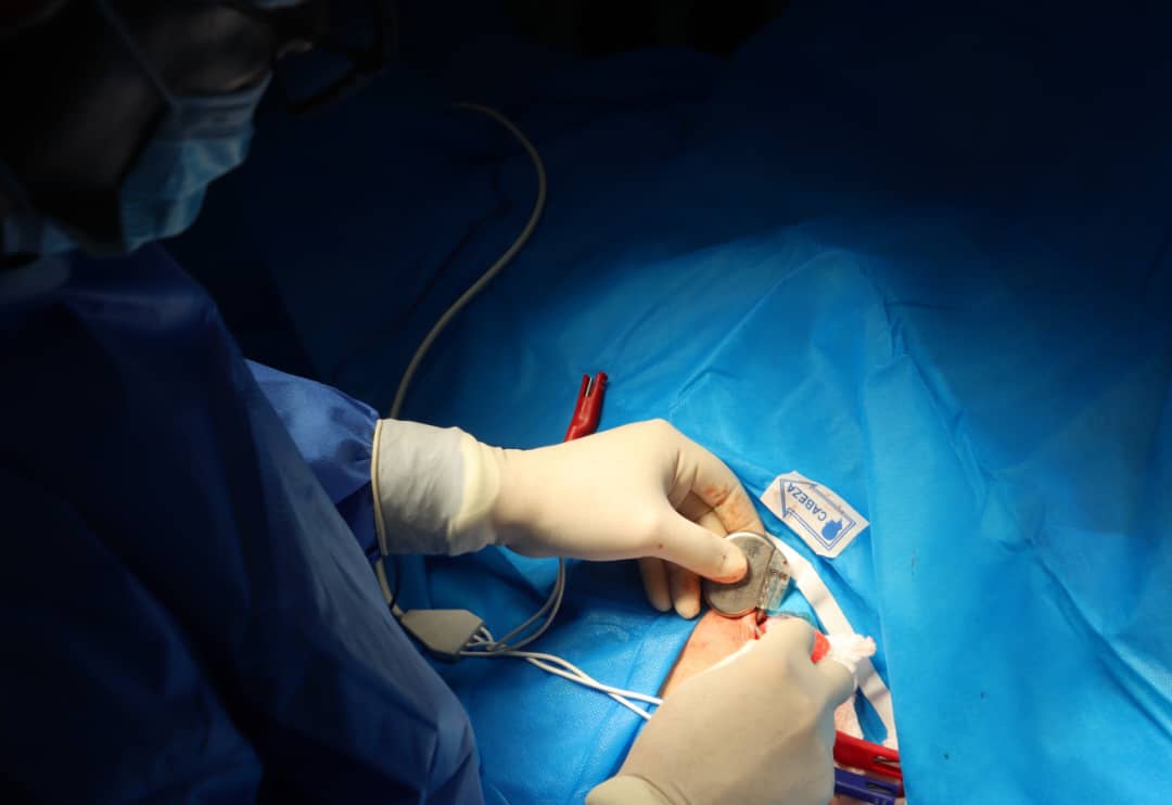 Siete pacientes reciben marcapasos en el Centro Cardiovascular de Oriente
