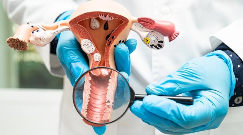 Médicos alertan sobre el cáncer de cuello uterino y promueven la vacunación contra el VPH