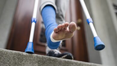 Cirugía extrema por estética: La "alargación de piernas" gana adeptos pese a meses de dolor y riesgo de complicaciones