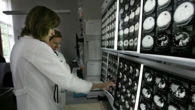 Alarmante Pronóstico Global: Muertes por Cáncer aumentarán un 75% para 2050