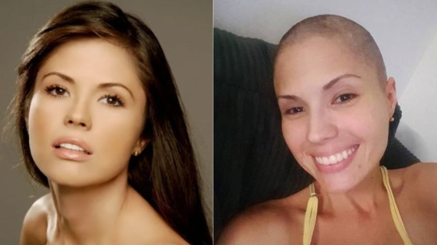 La actriz Carmen Alicia Lara requiere ayuda para costear su tratamiento contra la metástasis; abren GoFundMe