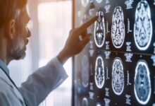 Científicos revelan que bacterias en tumores cerebrales generan resistencia a la quimioterapia