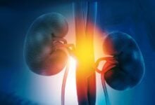 La enfermedad renal crónica dispara las alarmas en América Latina