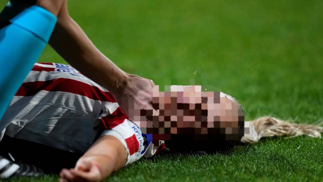 En el minuto 72, la defensa española se desplomó, luego de recibir el golpe involuntario. Los paramédicos le prestaron los primeros auxilios en el césped durante unos minutos