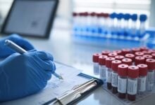 ¿Por qué personas saludables producen demasiado colesterol?