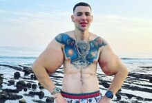 El "Popeye ruso" enfrenta la amputación doble de brazos tras inyectarse vaselina y Synthol