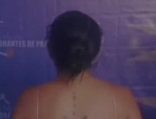 Mujer apuñaló a su pareja con una navaja en el sector Sabana Grande de Tinaquillo