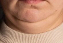 Lo que el tamaño de tu cuello puede revelar sobre tu salud