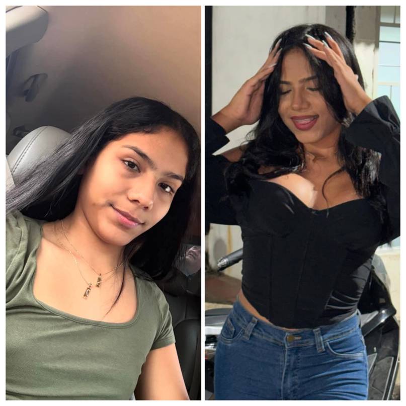 Emily Galaviz aclara sus cirugías: empezó por un problema respiratorio