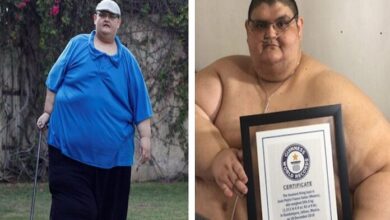 Muere Juan Franco, el mexicano que fue el hombre más obeso del mundo