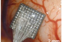 Neurotecnología: Implantes cerebrales ya logran «leer» la mente y recuperar movilidad