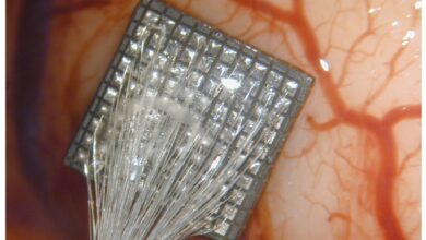 Neurotecnología: Implantes cerebrales ya logran «leer» la mente y recuperar movilidad