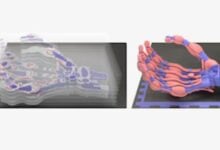 Hito médico: Ya es posible imprimir hueso en 3D directamente en el quirófano