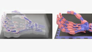 Hito médico: Ya es posible imprimir hueso en 3D directamente en el quirófano