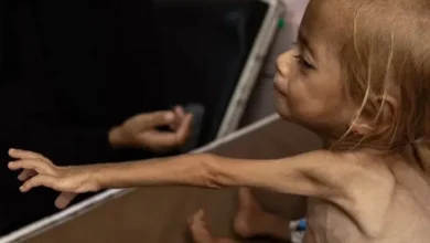 Alerta UNICEF: Casi 9.300 niños menores de cinco años en Gaza padecen desnutrición aguda