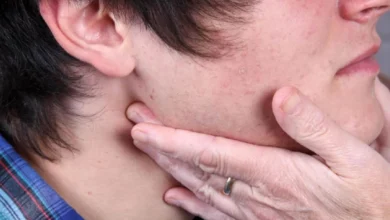 Ganglios inflamados: causas y síntomas de alerta