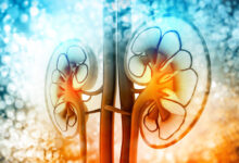 El trasplante de riñón será gratuito en Rusia