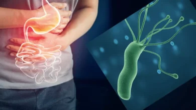 ¿Acidez constante? Todo lo que debes saber sobre la Helicobacter Pylori y cómo eliminarla