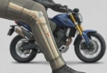 Fractura de tibia: La lesión más frecuente en accidentes de moto