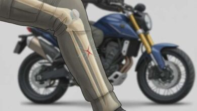Fractura de tibia: La lesión más frecuente en accidentes de moto