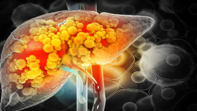 Guía para identificar el daño hepático antes de que sea tarde