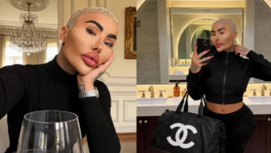 Muere Jordan James Parke, el influencer que gastó miles para parecerse a Kim Kardashian
