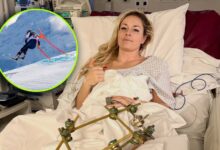 Lindsey Vonn revela que casi le amputan la pierna tras su caída olímpica